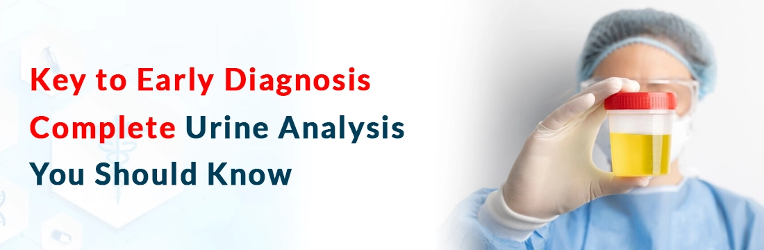  Key to Early Diagnosis: Complete Urine Analysis You Should Know